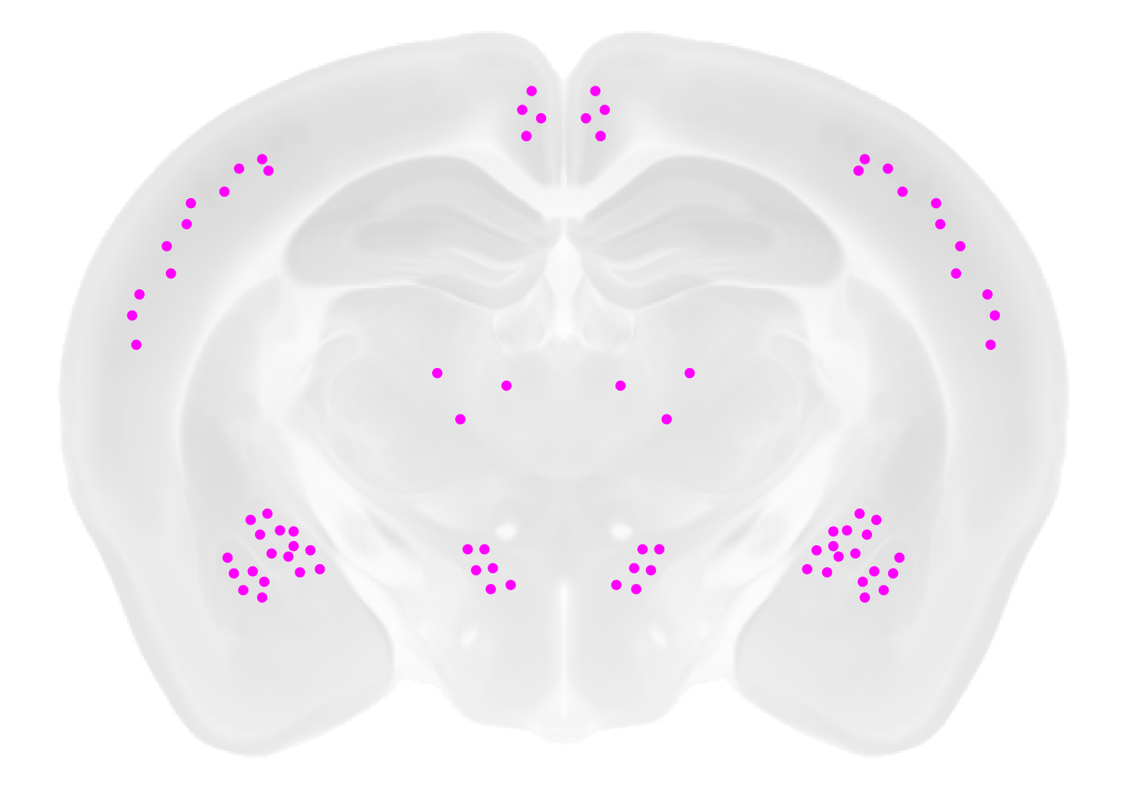 Brain Visualization 1